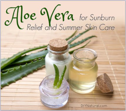 Natural Sunburn Relief  Natural sunburn relief, Natural remedies