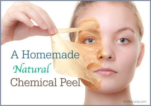 Homemade Chemical Peel