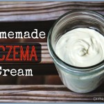 Homemade Eczema Cream DIY