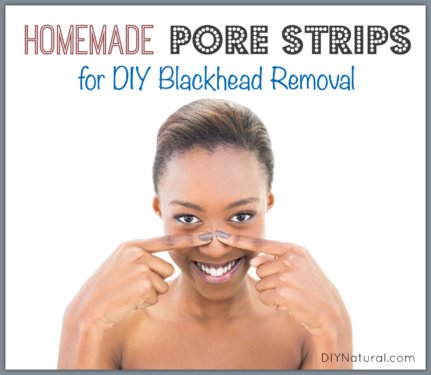 Homemade DIY Pore Strips