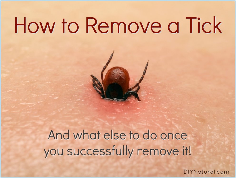 How to Remove A Tick And What to Do Once You've Been Bitten